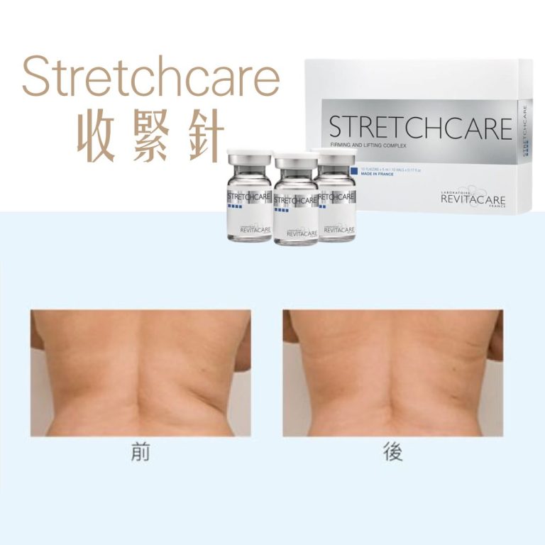 Stretchcare 收緊針