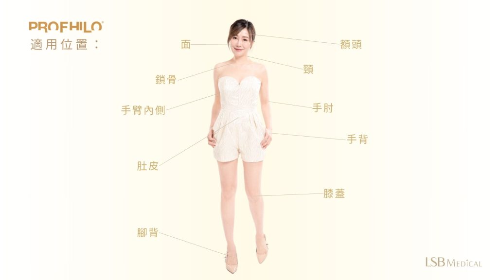 PROFHILO®適用位置