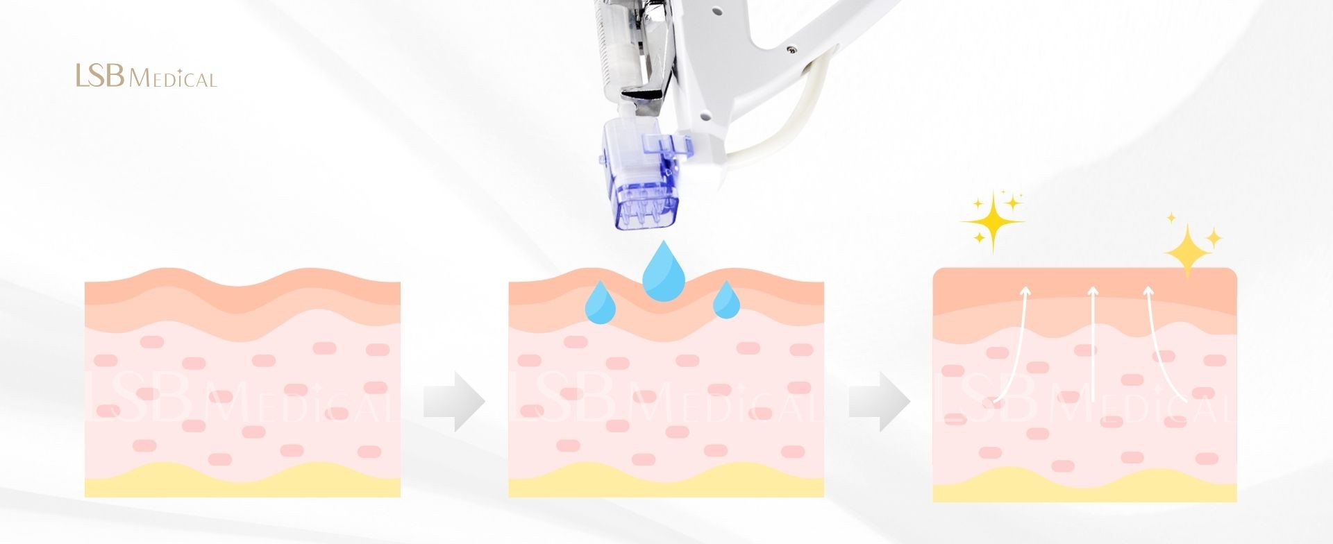 水光槍原理