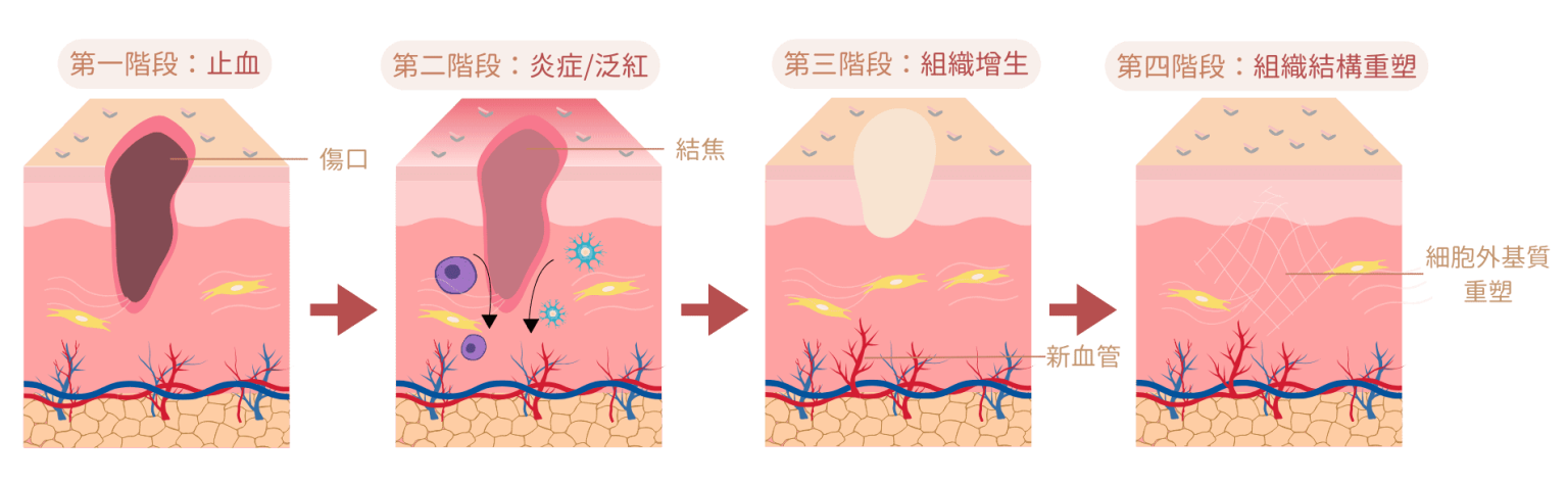 外泌體有助傷口癒合