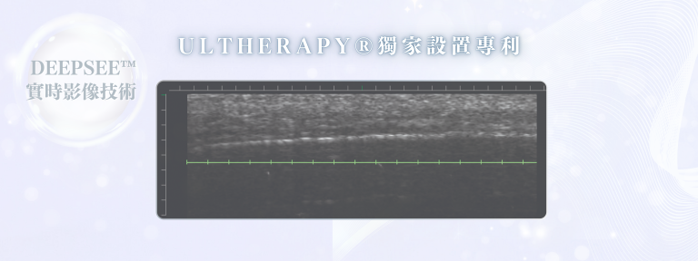 Ultherapy®獨家設置專利DeepSEE™實時影像技術