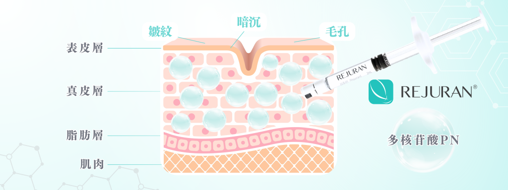 Rejuran Healer 麗珠蘭功效