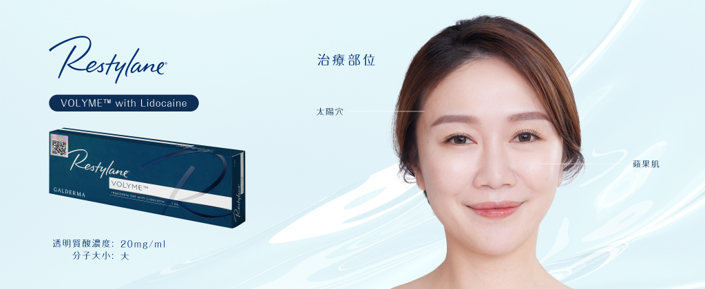 Restylane® VOLYME™ with Lidocaine