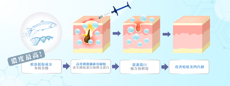 REJURAN麗珠蘭(藍盒)袪痘針