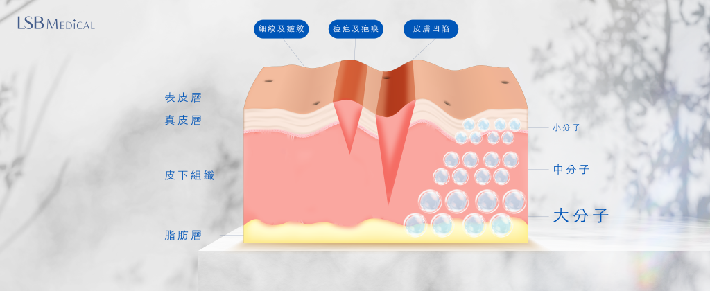 注射深淺層