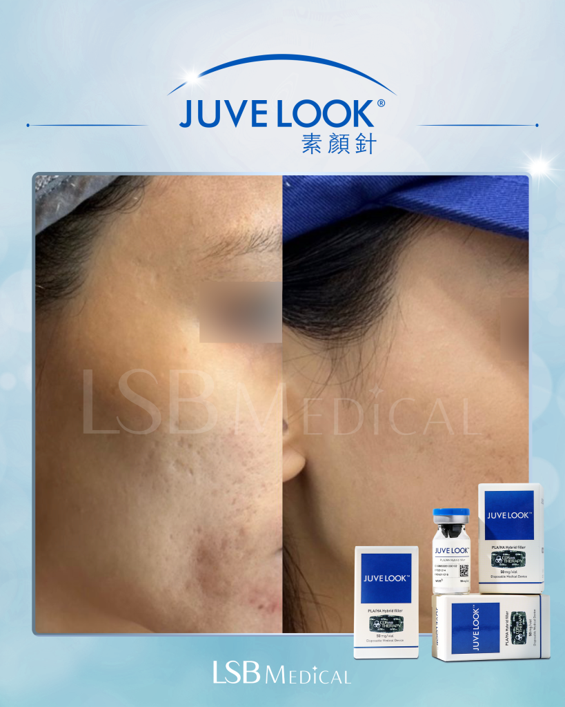 Juvelook