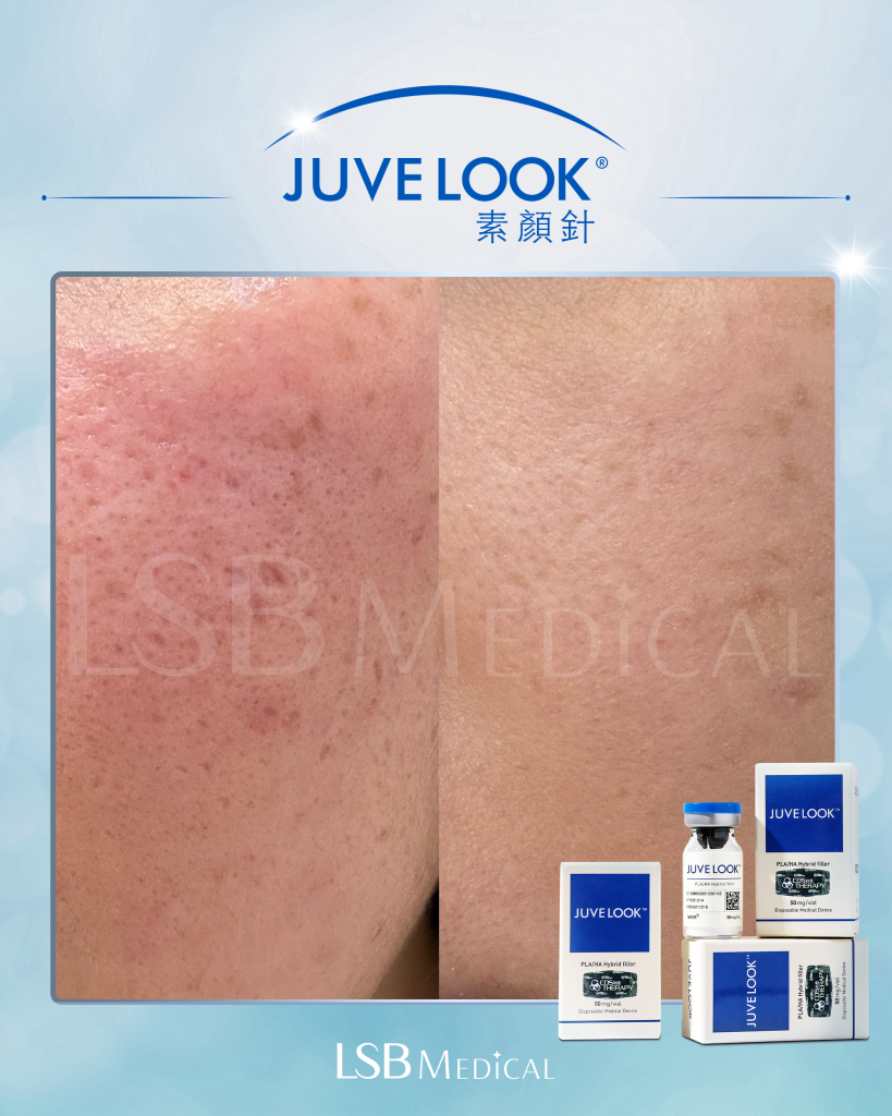 Juvelook