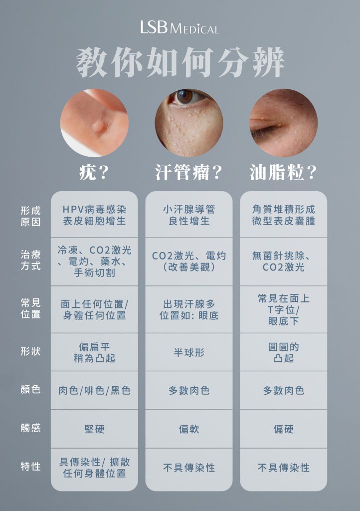 什麼是疣? 什麼是汗管瘤? 什麼是油脂粒?