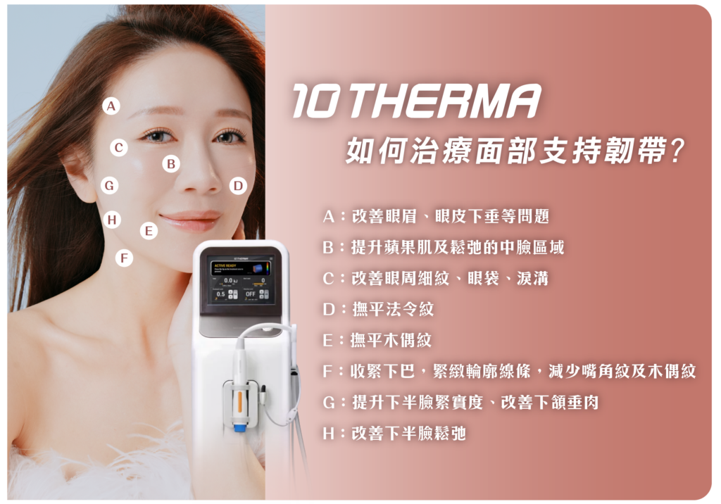 10Therma十倍電波拉皮面部8組支持韌帶（A至H）治療區域示意圖