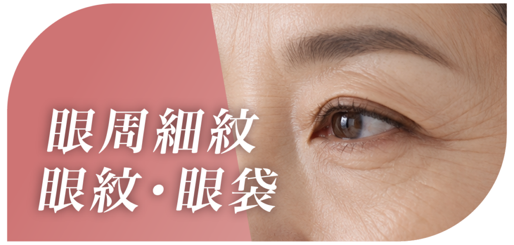 10Therma十倍電波拉皮適合人群圖示：面部鬆弛、眼紋、追求無創緊膚、熱瑪吉平替性價比方案
