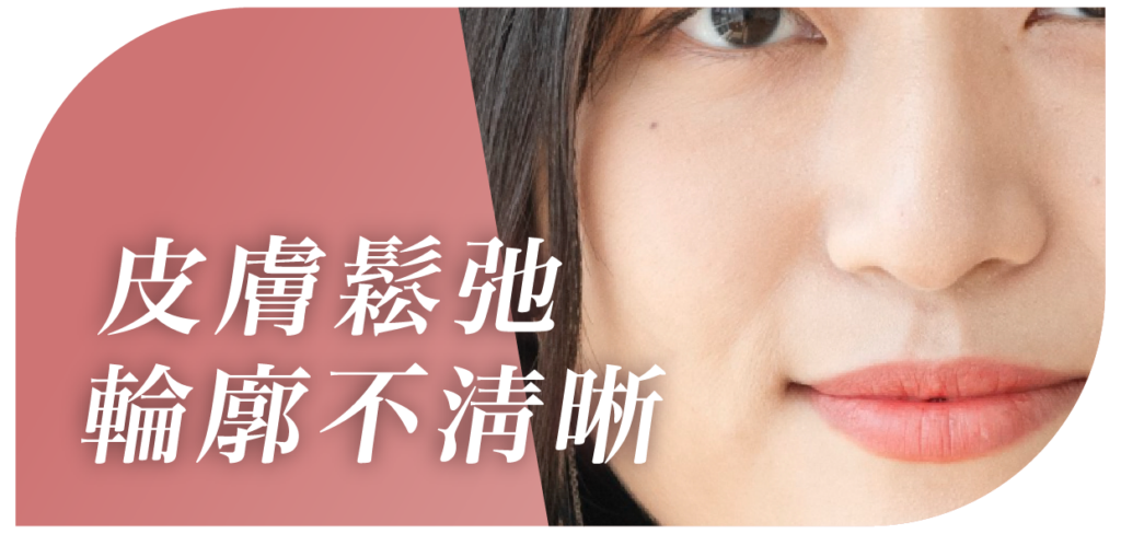 10Therma十倍電波拉皮適合人群圖示：面部鬆弛、眼紋、追求無創緊膚、熱瑪吉平替性價比方案