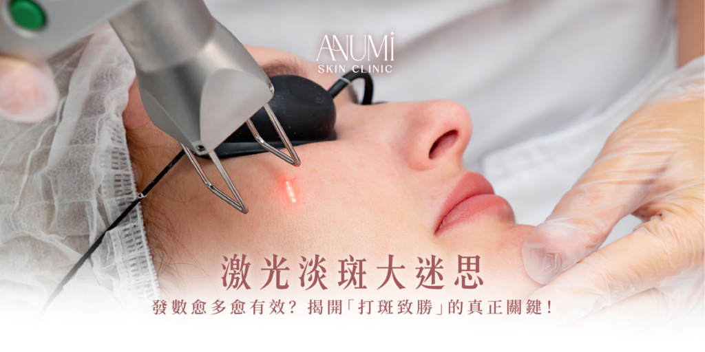 激光淡斑大迷思：發數愈多愈有效？揭開「打斑致勝」的真正關鍵！